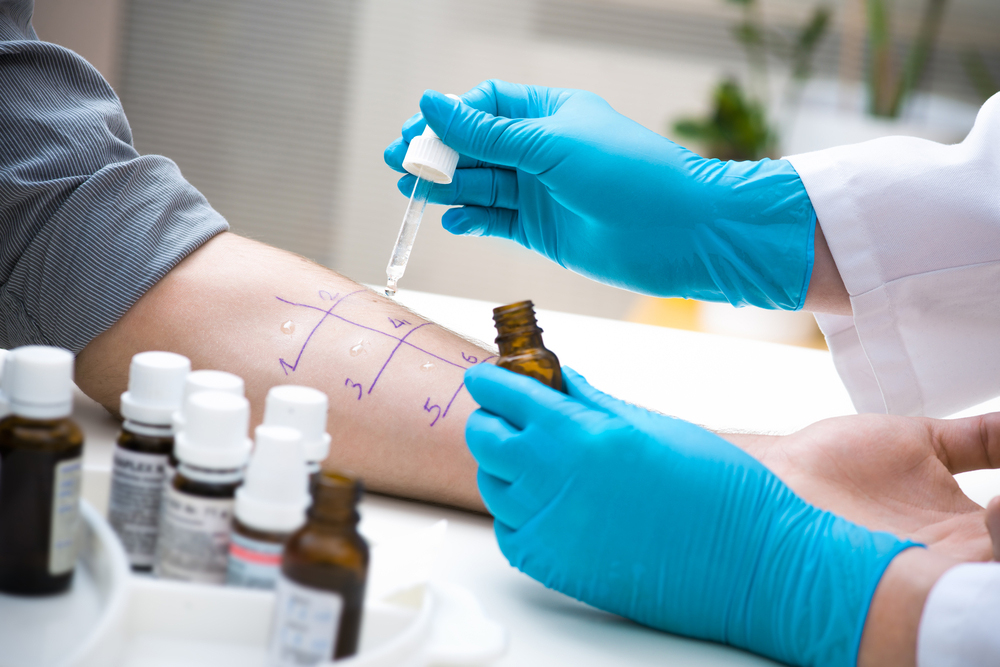 Allergy Test conducted by Dr.Dhiraj Jain in Mumbai